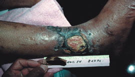 surgical interv fig1