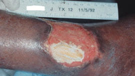 surgical interv fig2