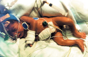 cur sta trans bg baby fig 1