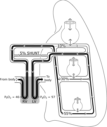 Set rec strai on shunt fig 2