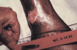 surgical interv fig3