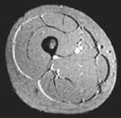 bg ac bal muscl mass fig1