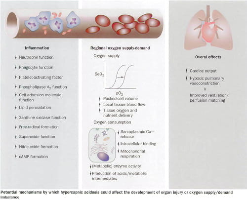 Carbon dioxide and the critically ill