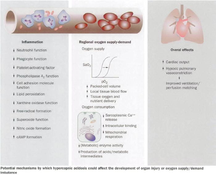 Carbon dioxide and the critically ill