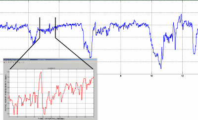FIGURE 1 : Foetal heart frequency