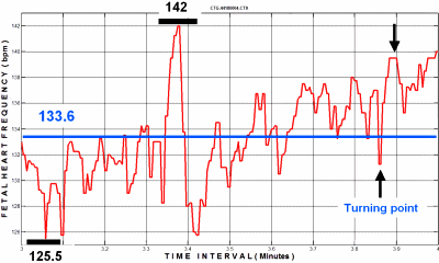 FIGURE 2 : FHF Mean frequency
