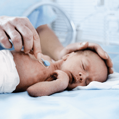 Transcutaneous monitoring